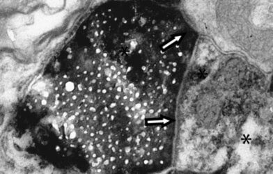 Electron microscopy
