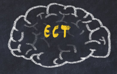 ECT - Electroconvulsive therapy