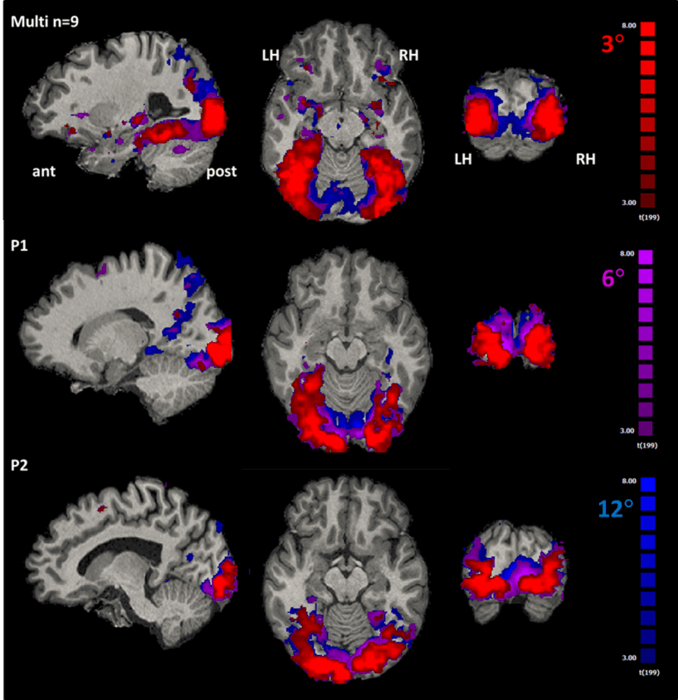 Visual memory - brain scans