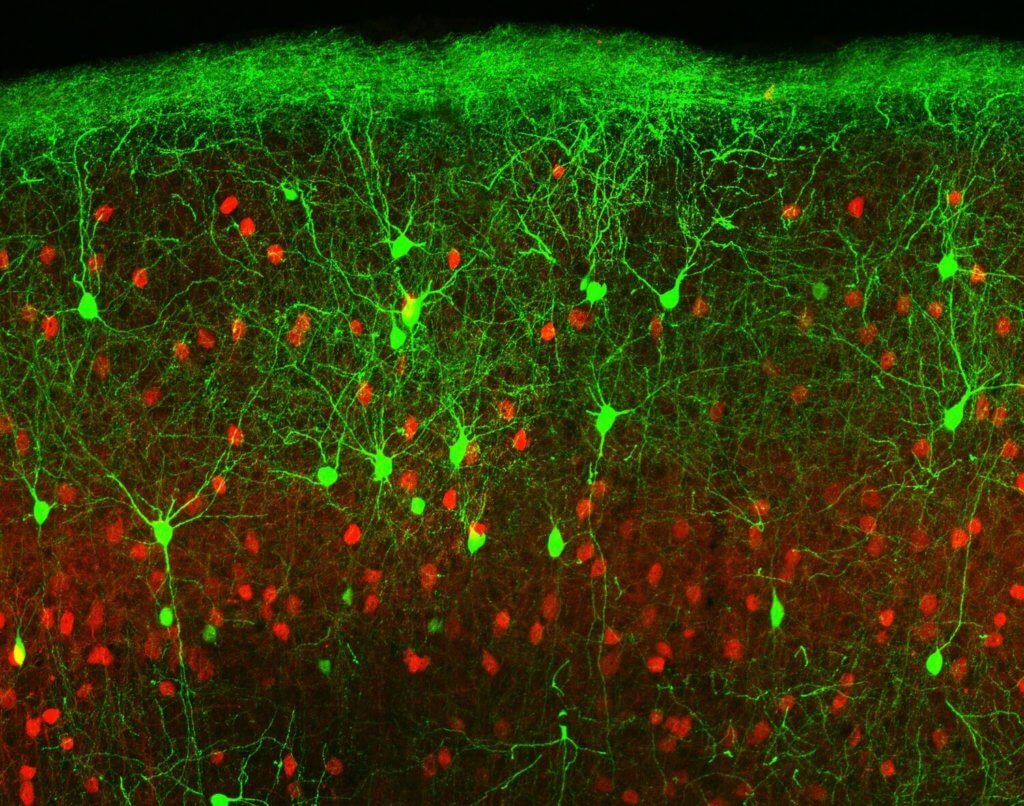 Nerve cells