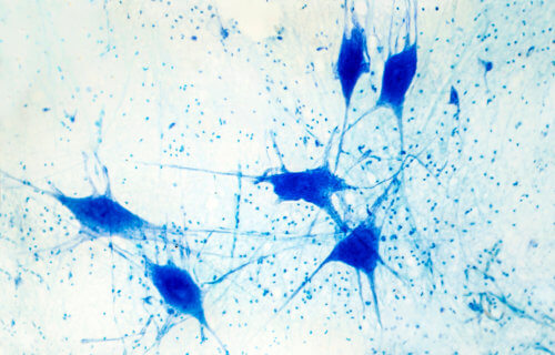 Light micrograph of human brain tissue showing neurons and glial cells