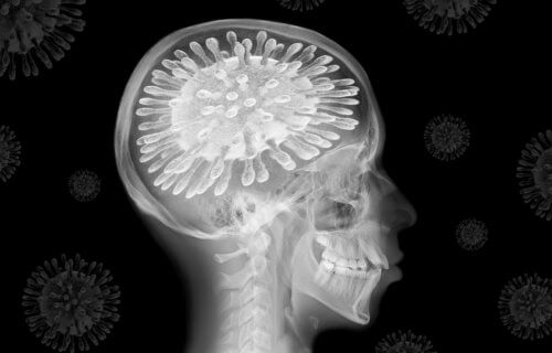 COVID-19 brain scan