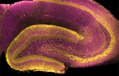 Schizophrenia origination study