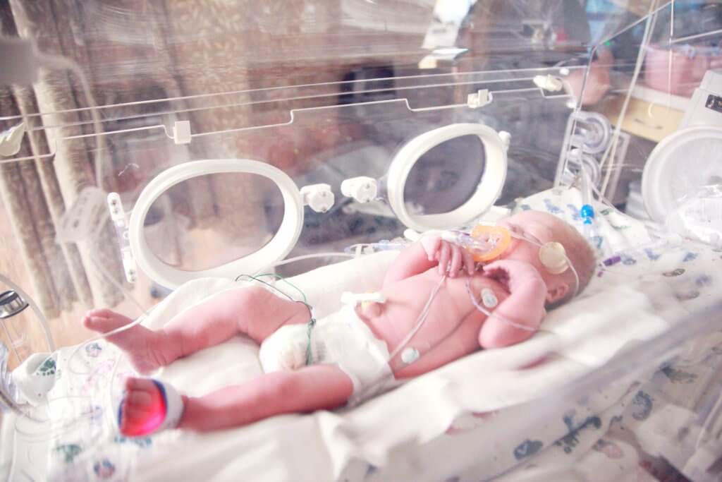 Premature baby in NICU
