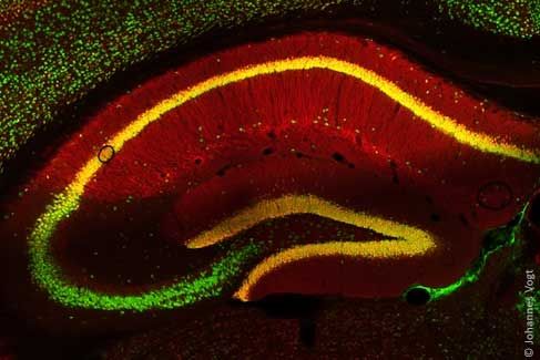 Mouse nerve cells
