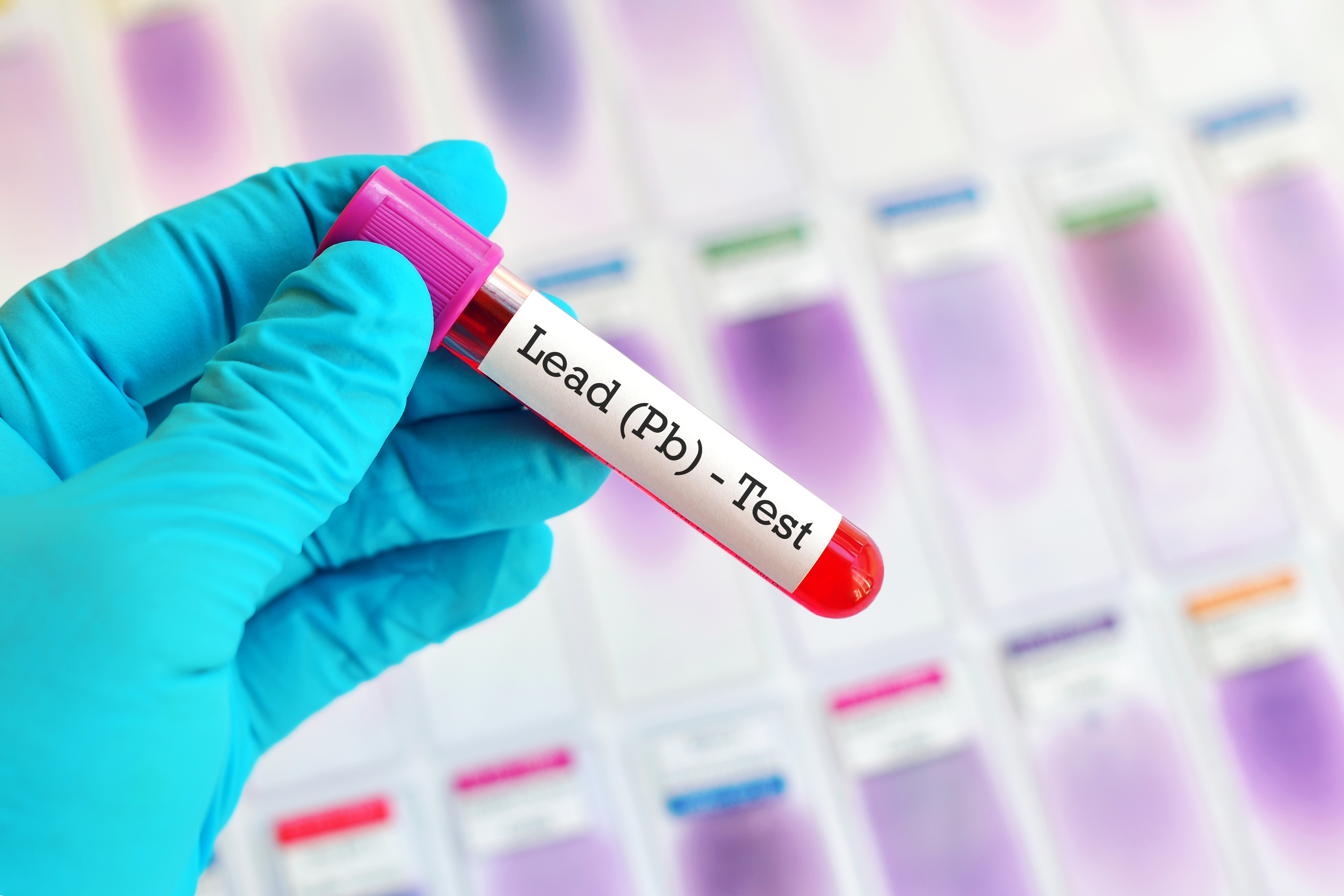 Blood sample for lead metal test