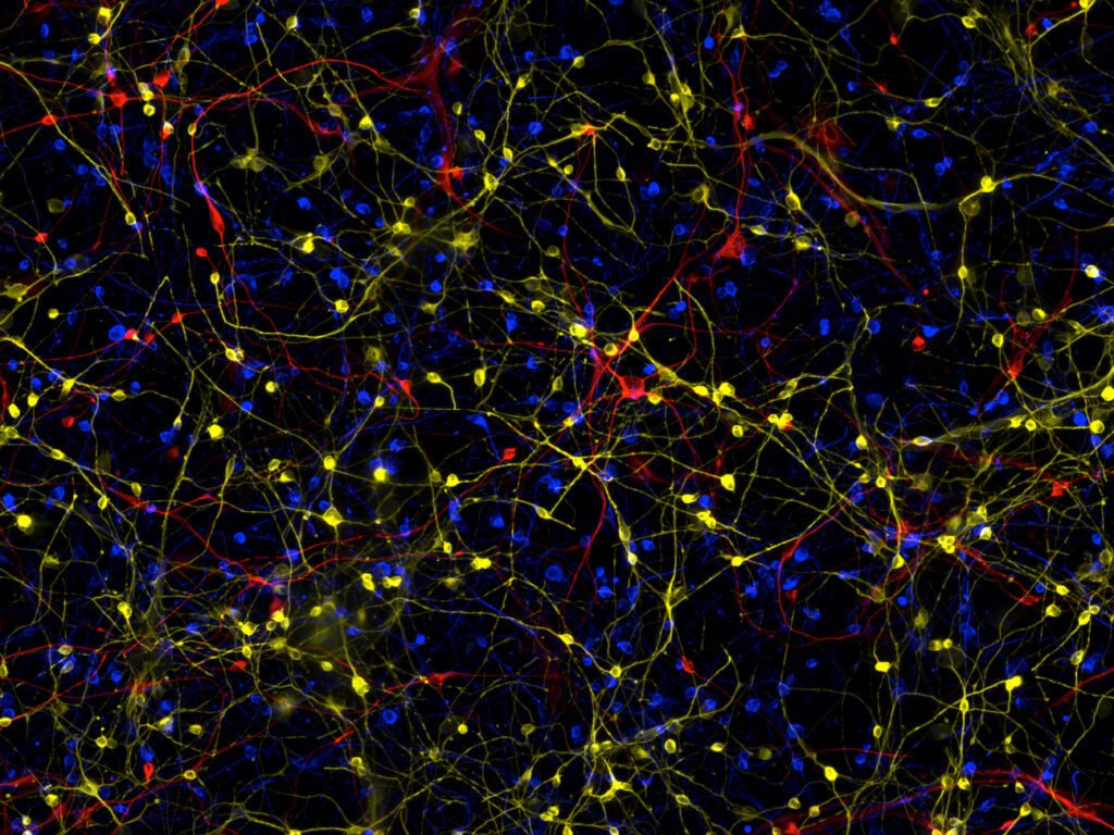 This image is a composite of induced neurons