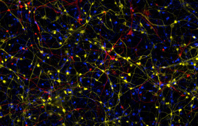 This image is a composite of induced neurons