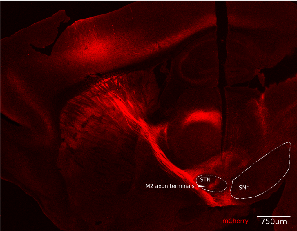 Red ("mCherry") staining highlights axonal projections from the motor cortex M2